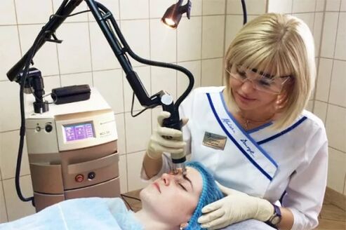 Laser rejuvenation procedure in a beauty parlor