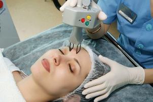Laser fractional facial skin rejuvenation