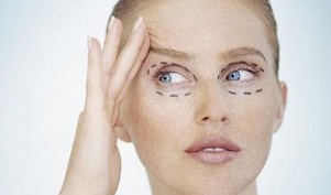 types of blepharoplasty for rejuvenating the skin around the eyes
